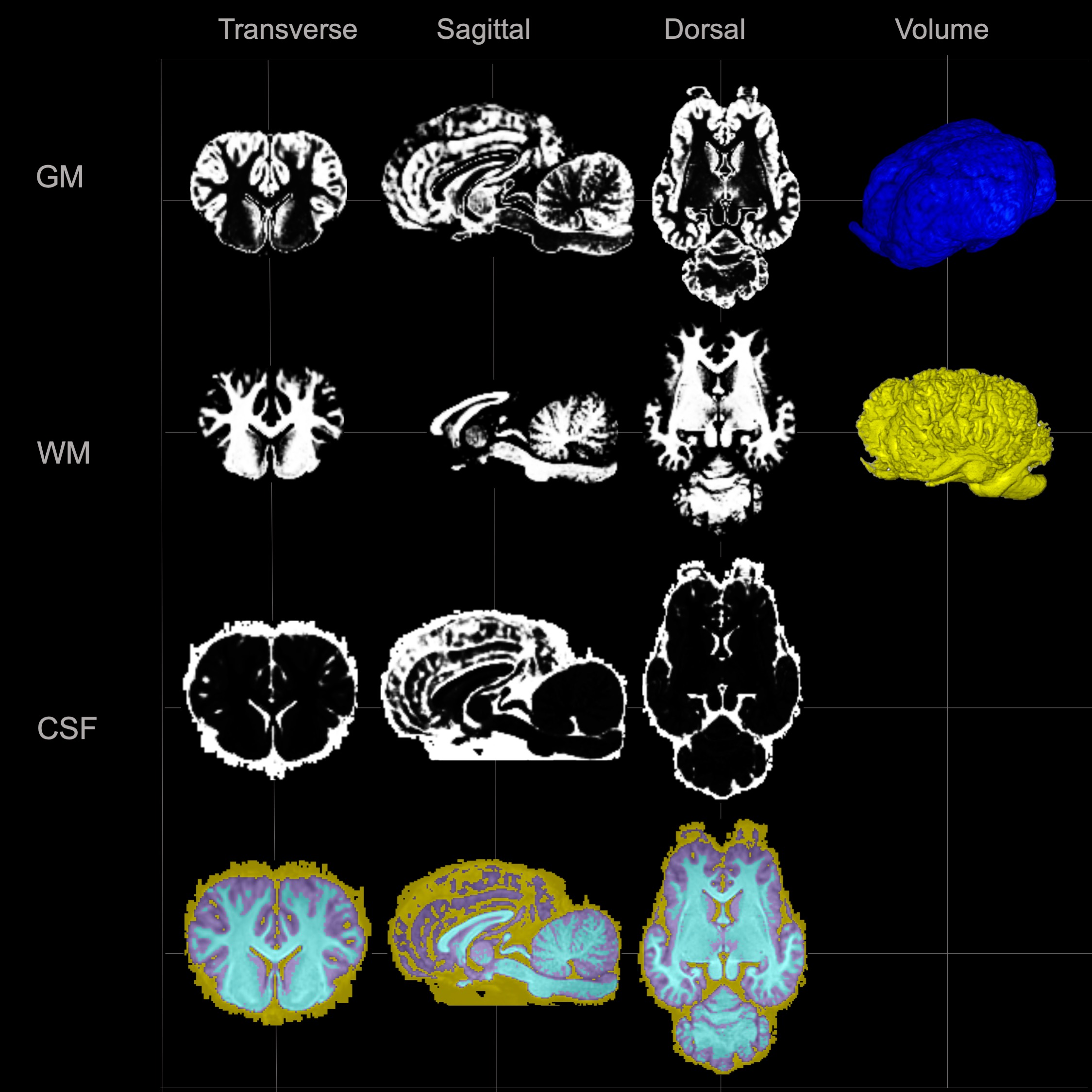 【美品・電子版使用済】Diagnostic Imaging: Brain 脳画像 Cornell radiologist develops advanced atlases of animal brains